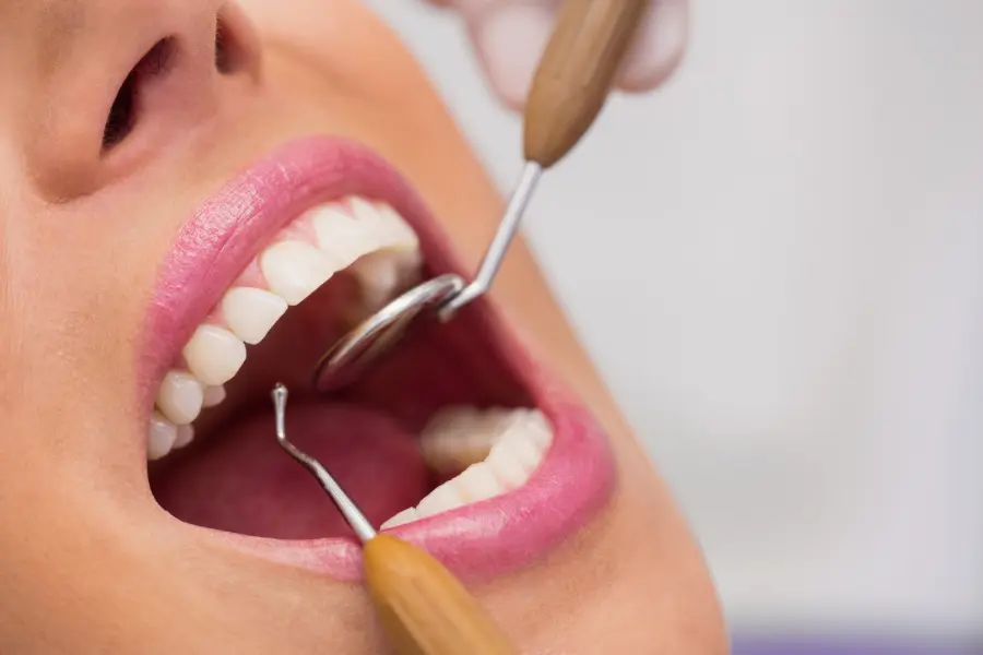 All General Dental Treatments